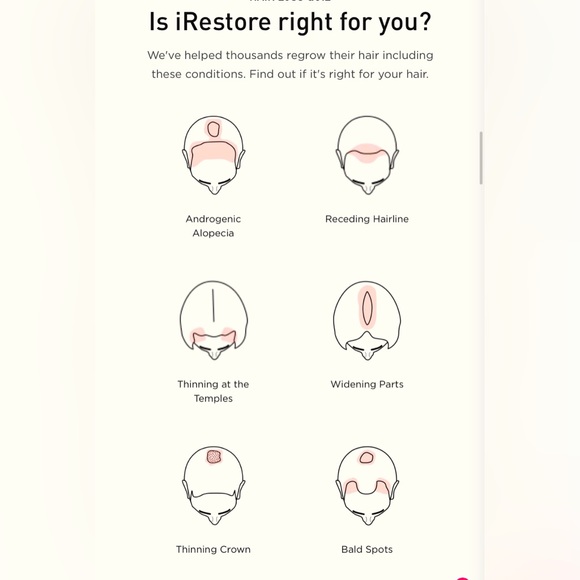 iRestore Hair Growth Helmet - Picture 2 of 8